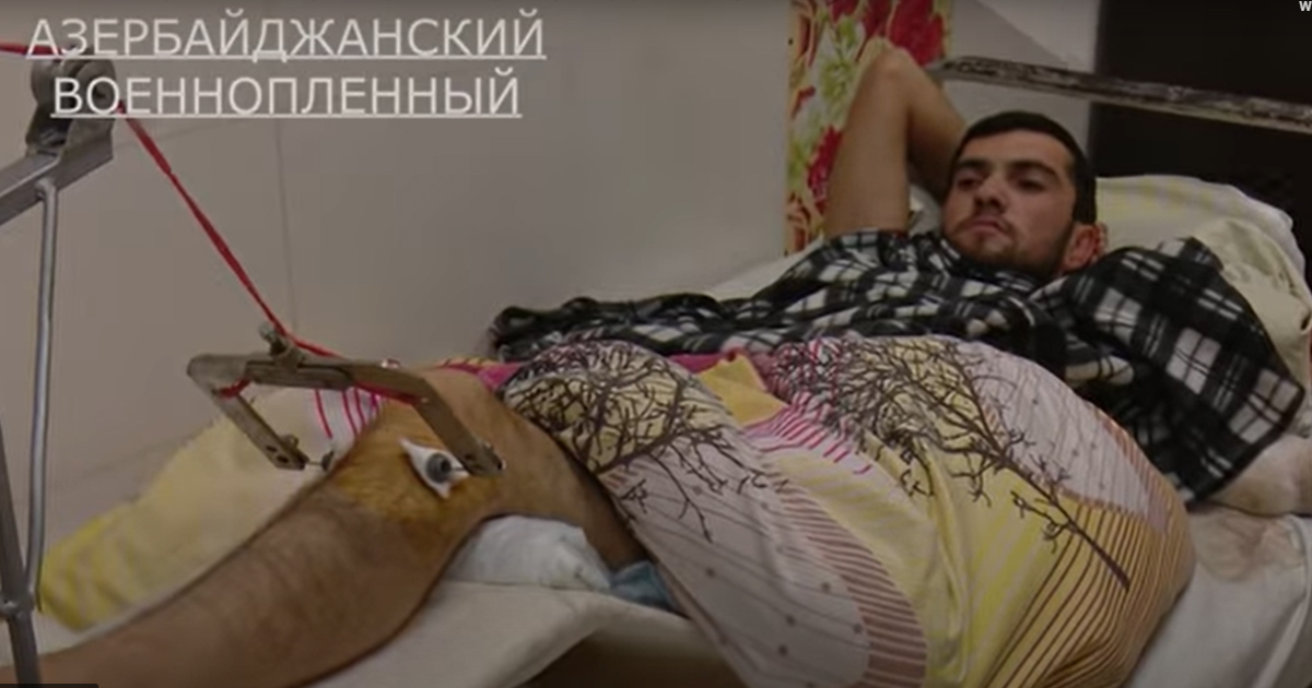 Հայ բժիշկները վիրահատել են ադրբեջանցի ռազմագերուն