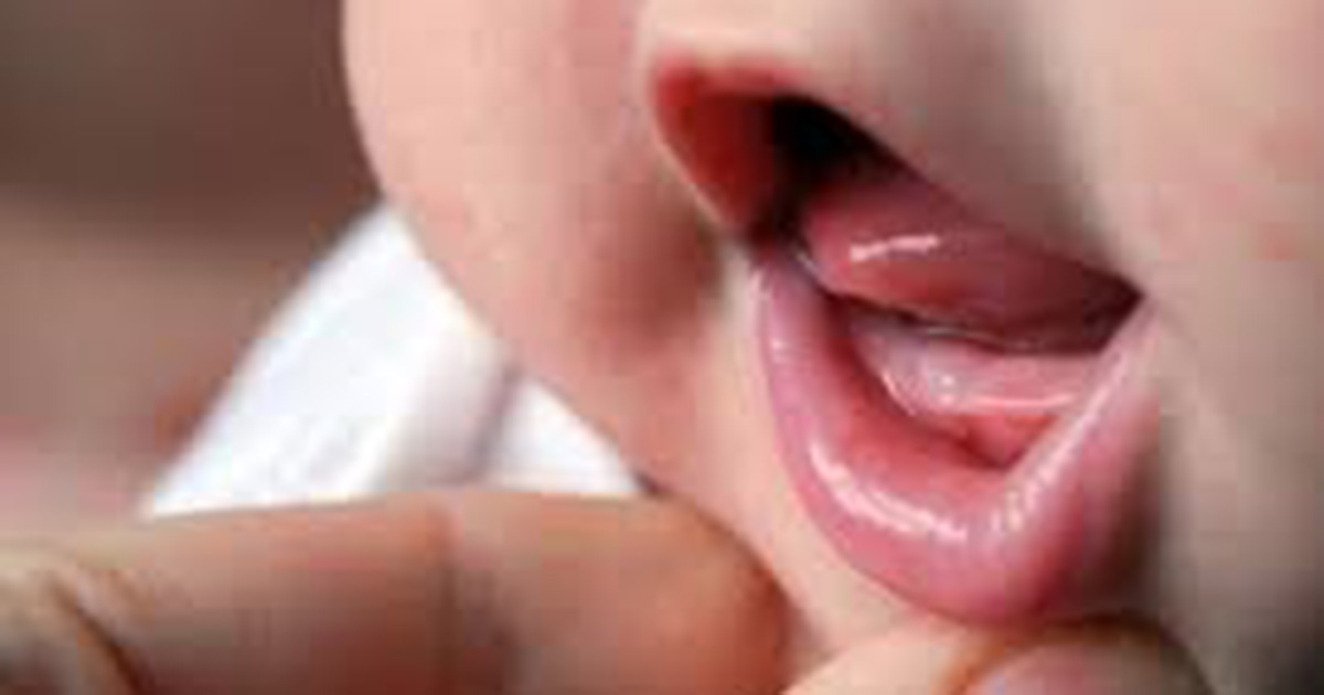 Պետք չէ արհեստականորեն փորձել միջամտել երեխայի ատամների ծկթման պրոցեսին